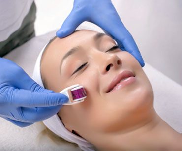 Mésolift par Microneedling à Hyèes / Toulon - Dr Alain Plault